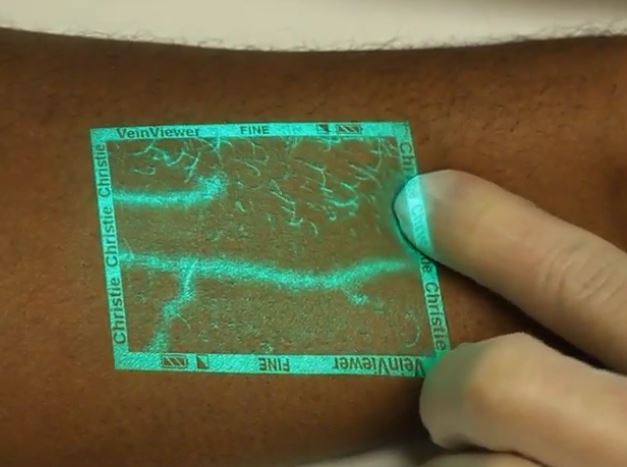 Device that makes your veins glow thru your skin